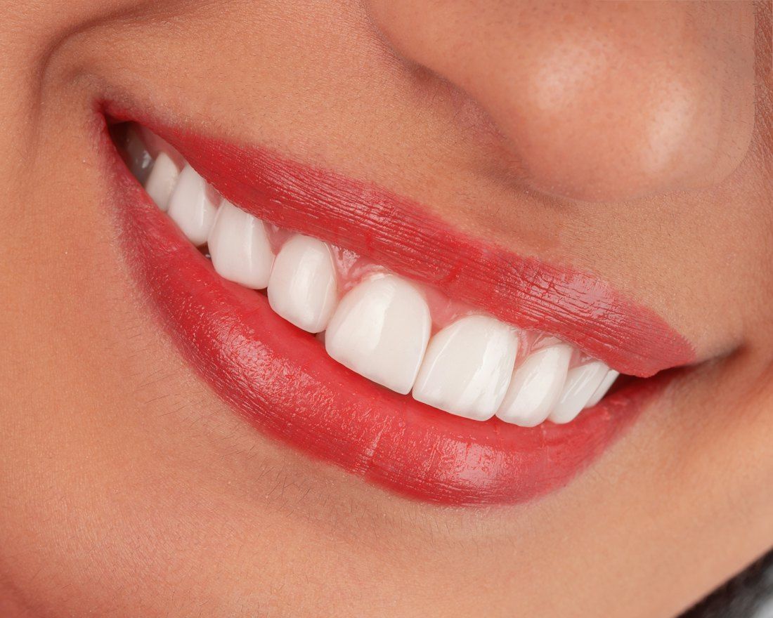 A close-up of a bright smile