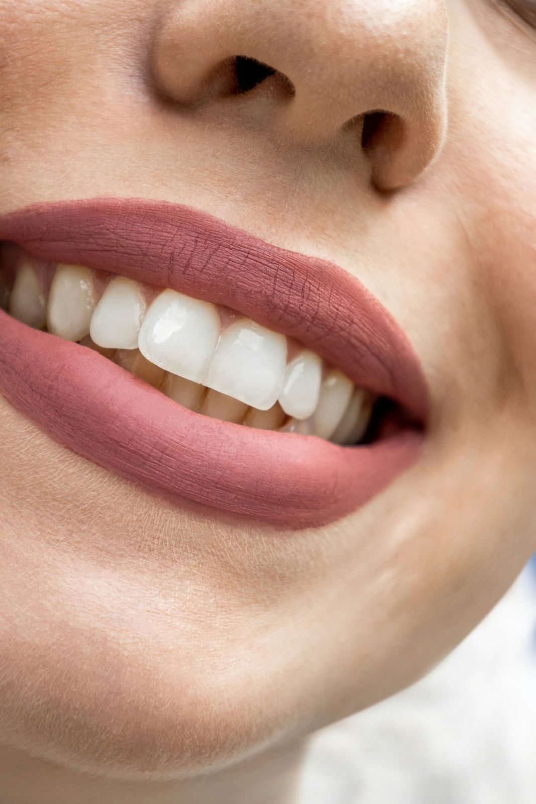A close-up of a smile with white, even teeth