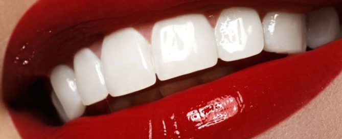 hollywood-smile-design-makeover