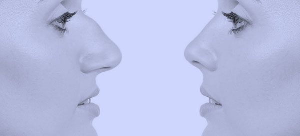 rhinoplasty-in-turkey